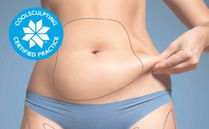 CoolSculpting