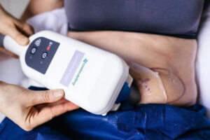 Coolsculpting aplicator